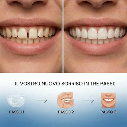 Faccette Adattabili e Rimovibili